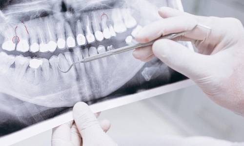 Оздоровительный комплекс Дагомыс - Фото 43