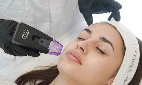 Отель Комильфо